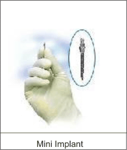 Before Dental Implant