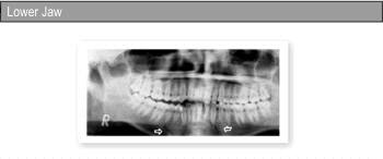 Orthognathic Surgery
